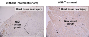 diagrams of microscopic views of heart tissue with and without treatment